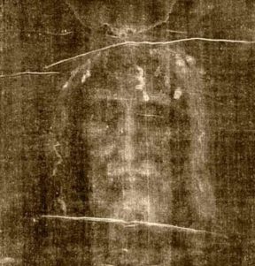 Jesucristo sufrió una luxación mandibular por los golpes recibidos