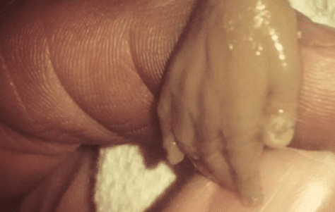 Derecho a la vida: Una imagen vale más que mil palabras