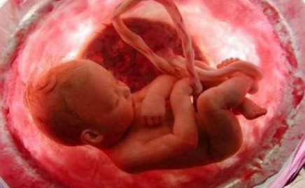 El aborto, un pecado grave que excomulga automáticamente