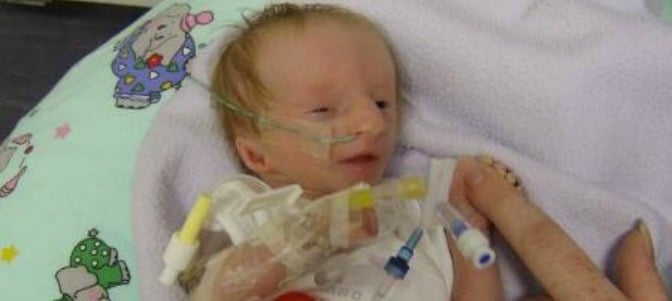 Conoce a la niña ‘más pequeña del mundo’ a la que dieron un año de vida y ya tiene 9