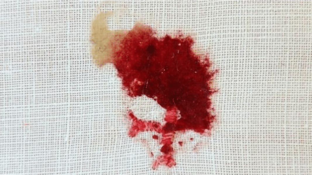 Un corazón que aún late