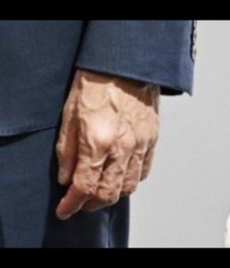 Primer plano de la mano de un hombre con venas marcadas y aspecto envejecido, que simboliza el desgaste moral y político.