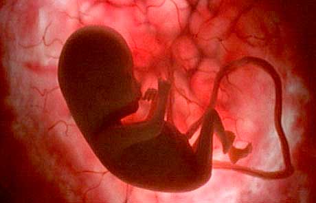 Roma ciudad muerta, el dialogador Papa Francisco, camino del suicidio, el pasado reciente del Vaticano.